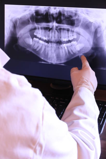 Best Broken or Cracked Tooth Emergency Dentist in Port Ewen, NY